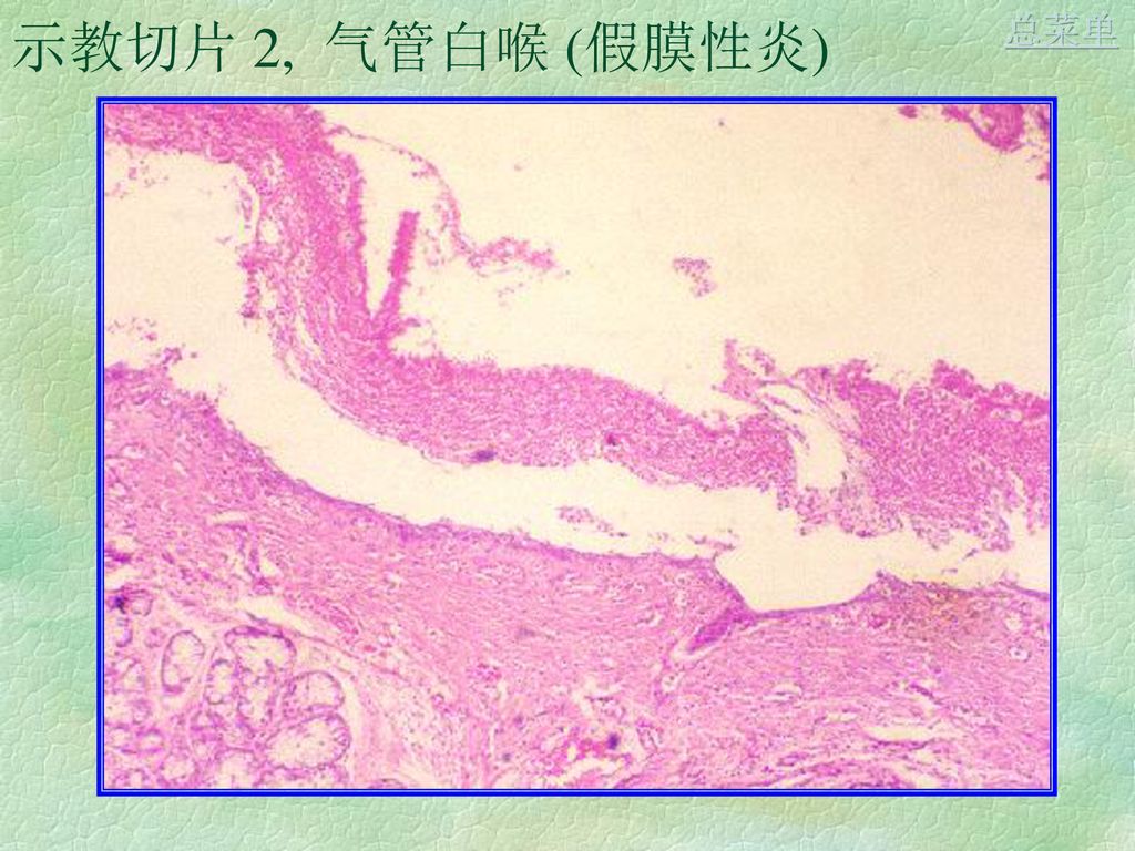 实验4, 炎症 (inflammation) 总菜单 切片: 1, 纤维素