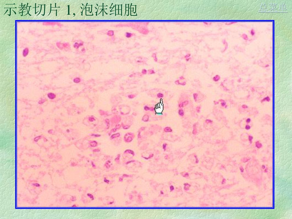 实验4, 炎症 (inflammation) 总菜单 切片: 1, 纤维素性心包炎