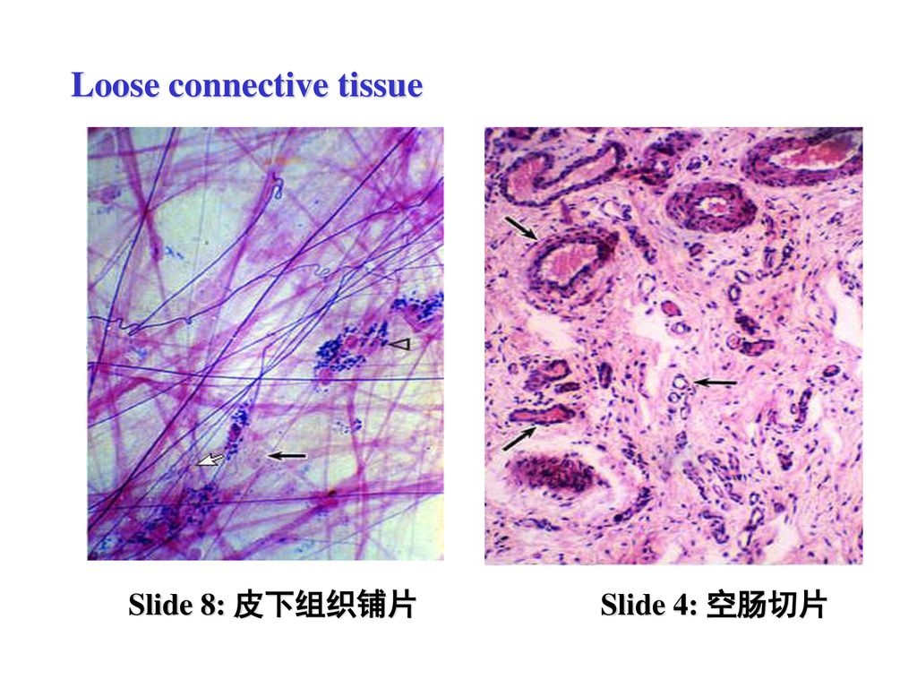 结缔组织 connective tissue