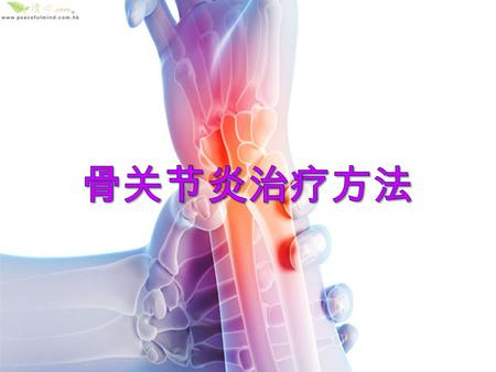 骨关节炎的症状有全身性与局部性两类，原则上身 体各个关节都可以发生骨关节炎，如手，肩，脊柱 （颈椎，腰椎等）和髋关节，但全身性的以手指关 节最常见，局部性的则以膝关节最多见。 （ 1 ）一般都是上了年纪的人 （ 2 ）有疼痛和活动受限等症状 （ 3 ） X 线检查有关节边缘骨质增生 （ 4 ）还要排除其他类似疾病.