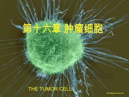 THE TUMOR CELL Breast Epithelial Tumor Cell.