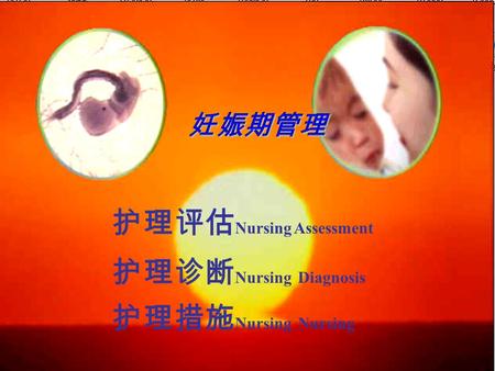 护理评估 Nursing Assessment 护理诊断 Nursing Diagnosis 护理措施 Nursing Nursing.