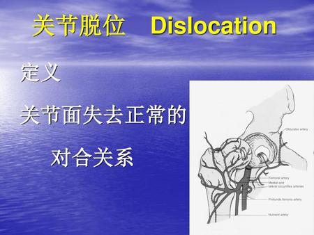 关节脱位 Dislocation 定义 关节面失去正常的 对合关系.