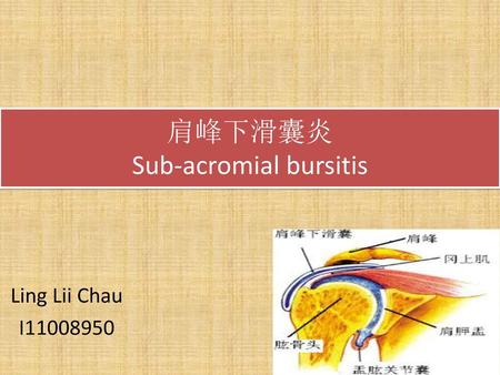 肩峰下滑囊炎 Sub-acromial bursitis