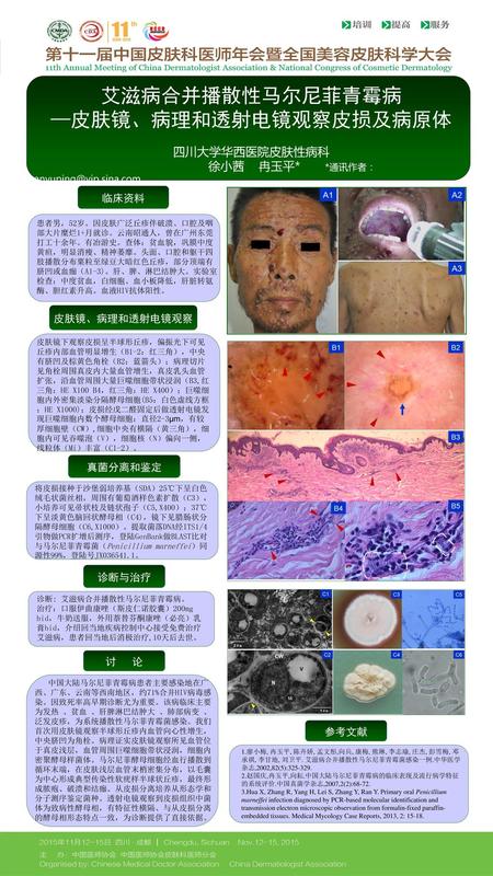 —皮肤镜、病理和透射电镜观察皮损及病原体