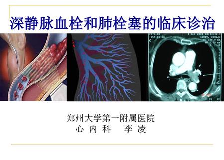 深静脉血栓和肺栓塞的临床诊治 郑州大学第一附属医院 心 内 科 李 凌.