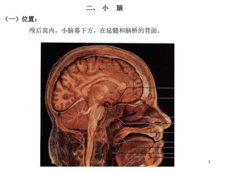 二、 小 脑 （一）位置： 颅后窝内，小脑幕下方，在延髓和脑桥的背面。.