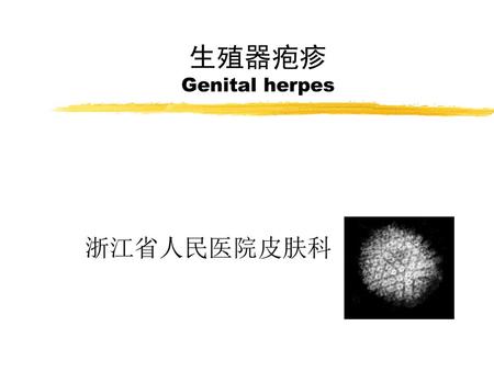 生殖器疱疹 Genital herpes 浙江省人民医院皮肤科.