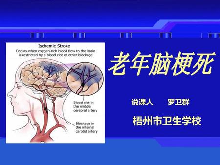 老年脑梗死 说课人 罗卫群 梧州市卫生学校.