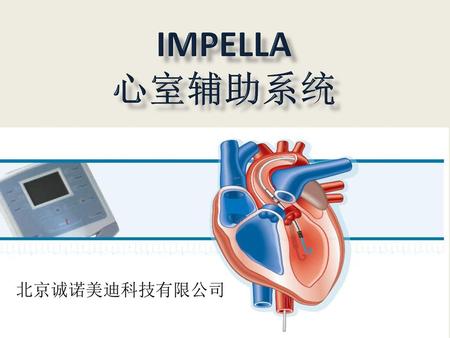 Impella 心室辅助系统 北京诚诺美迪科技有限公司.