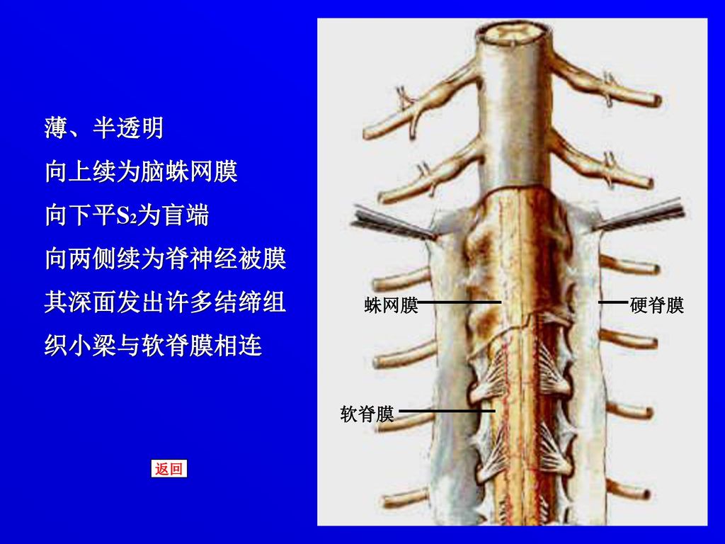 薄、半透明 向上续为脑蛛网膜 向下平S2为盲端 向两侧续为脊神经被膜 其深面发出许多结缔组 织小梁与软脊膜相连 蛛网膜 硬脊膜 软脊膜 返回