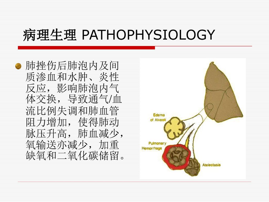 胸部损伤thoracic Trauma 浙江大学医学一系心胸外科王永清 Ppt Download