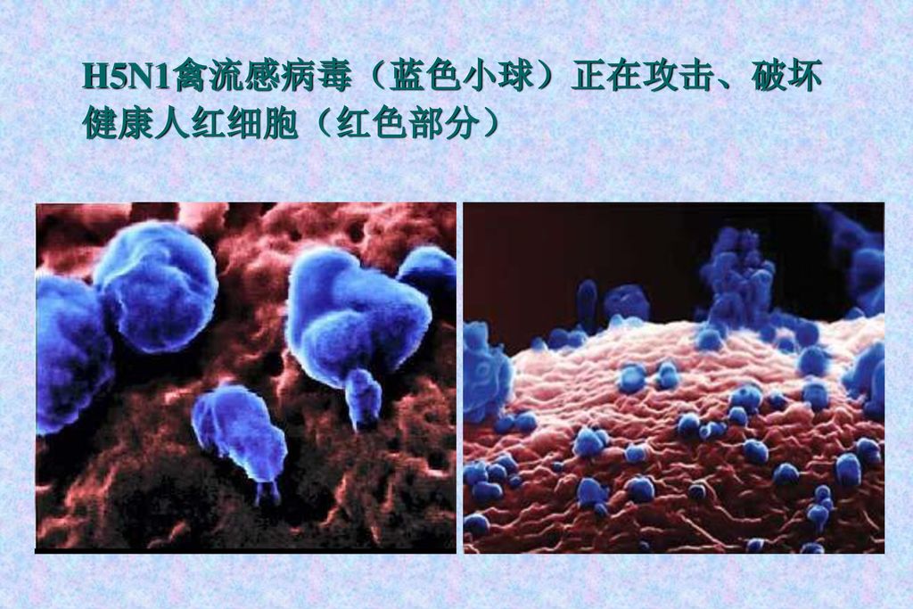 H5N1禽流感病毒（蓝色小球）正在攻击、破坏健康人红细胞（红色部分）