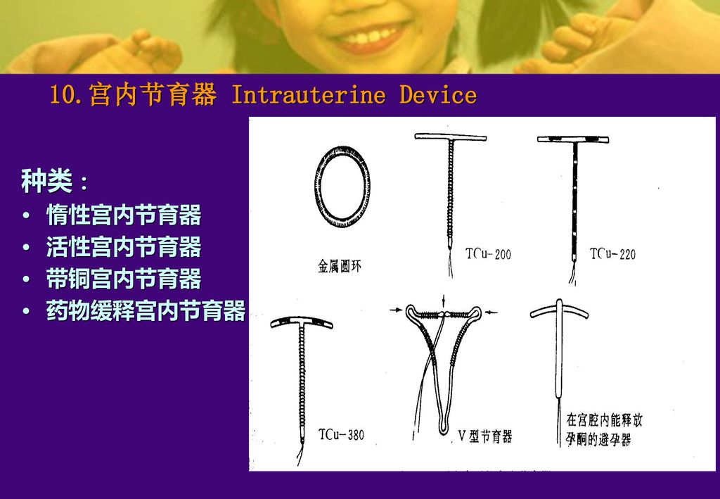 10.宫内节育器 Intrauterine Device