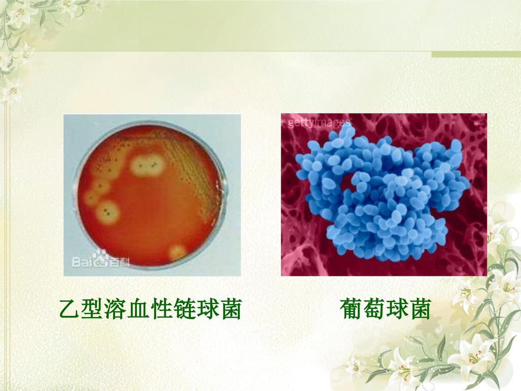 乙型溶血性链球菌 葡萄球菌