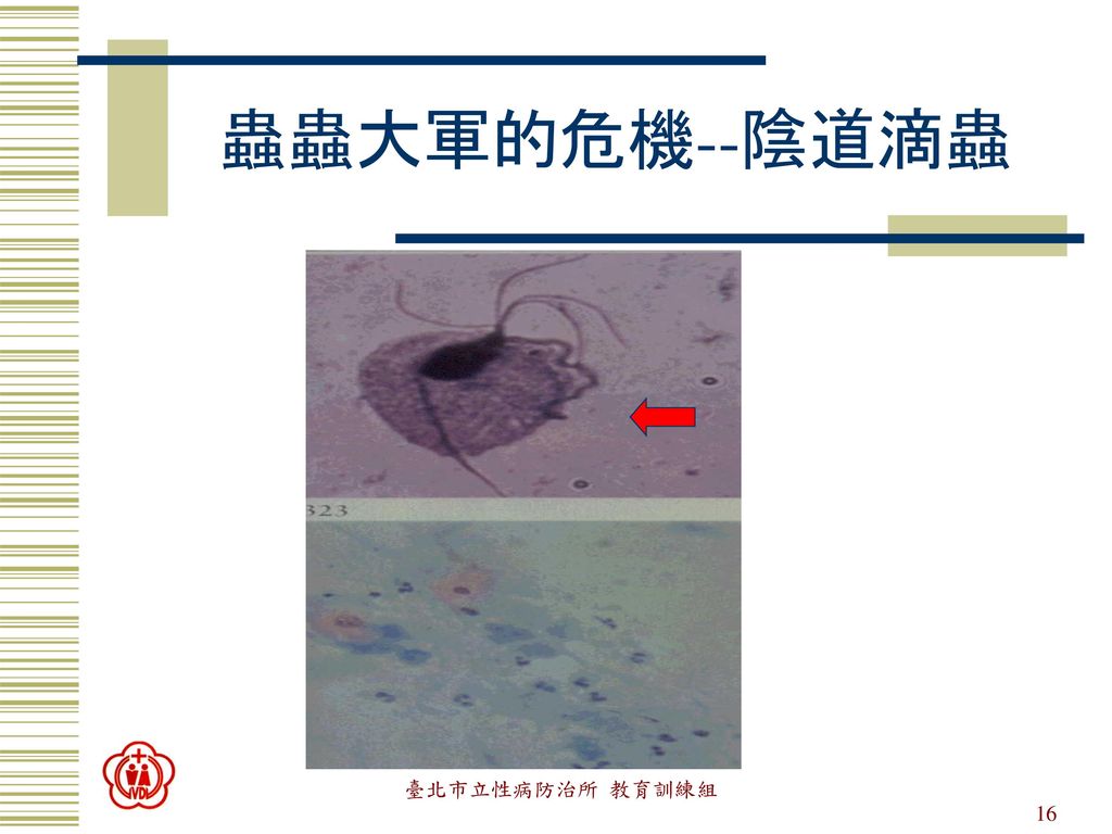 蟲蟲大軍的危機--陰道滴蟲 臺北市立性病防治所 教育訓練組 性傳染病與我有關嗎