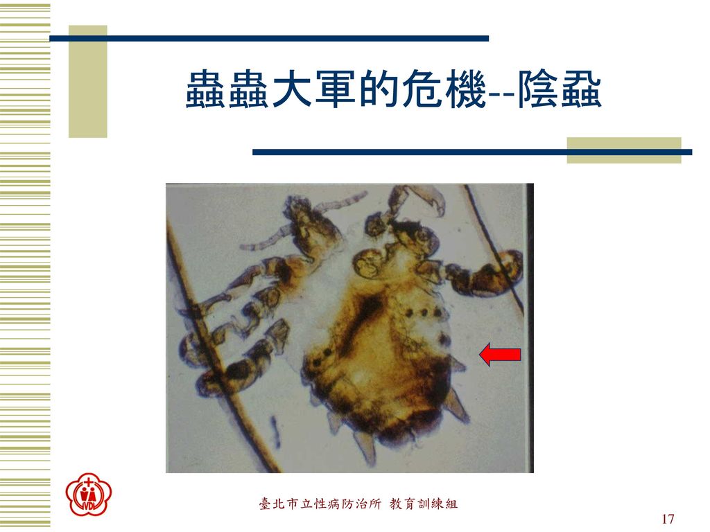 蟲蟲大軍的危機--陰蝨 臺北市立性病防治所 教育訓練組 性傳染病與我有關嗎
