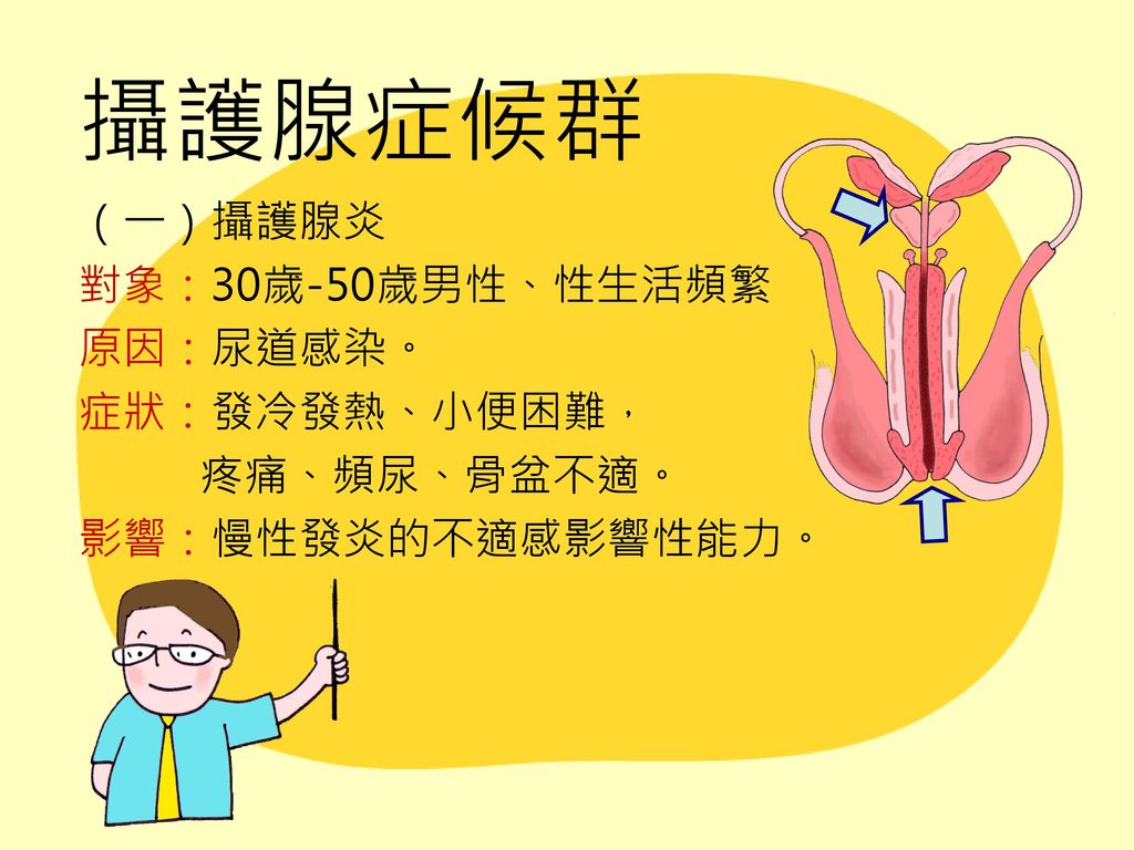攝護腺症候群 （一）攝護腺炎 對象：30歲-50歲男性、性生活頻繁 原因：尿道感染。 症狀：發冷發熱、小便困難，