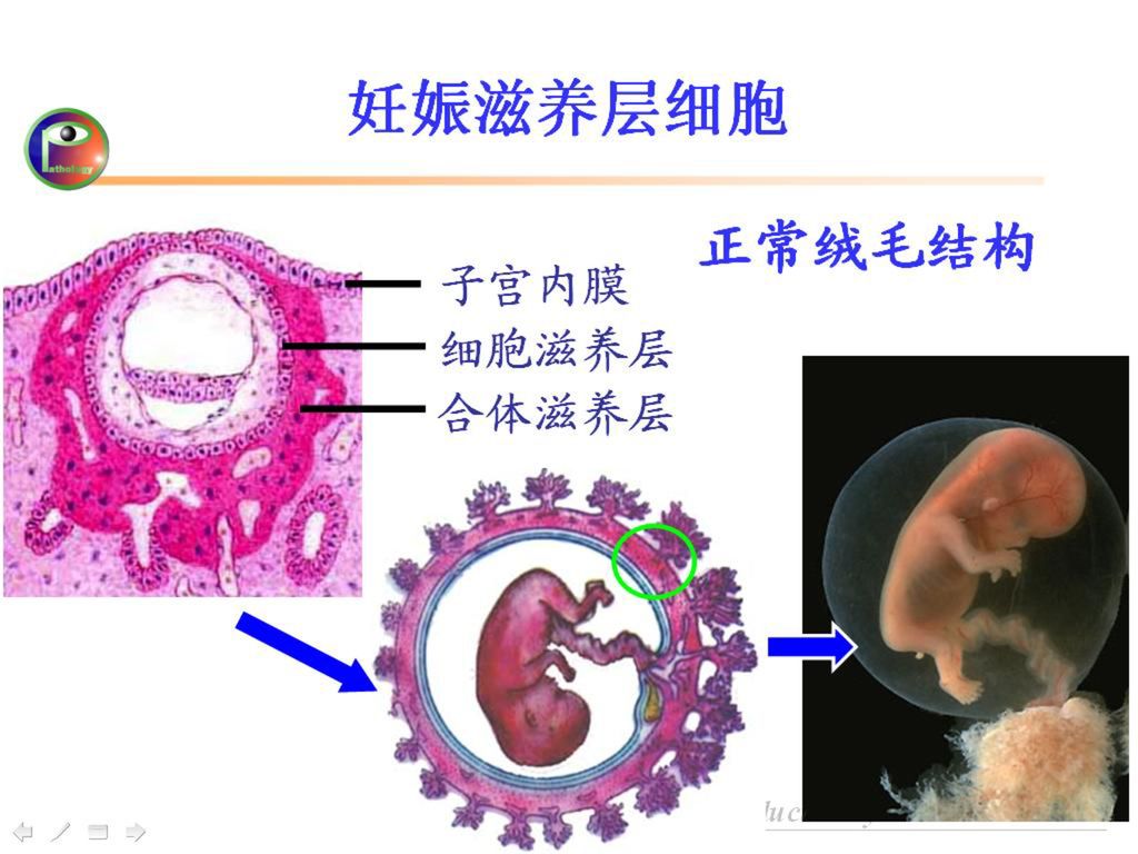 妊娠滋养层细胞