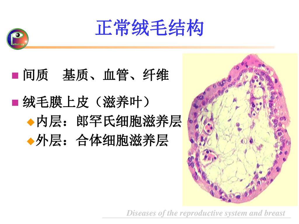 正常绒毛结构 间质 基质、血管、纤维 绒毛膜上皮（滋养叶） 内层：郎罕氏细胞滋养层 外层：合体细胞滋养层