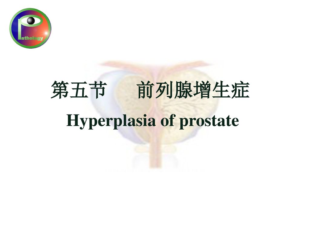 第五节 前列腺增生症 Hyperplasia of prostate