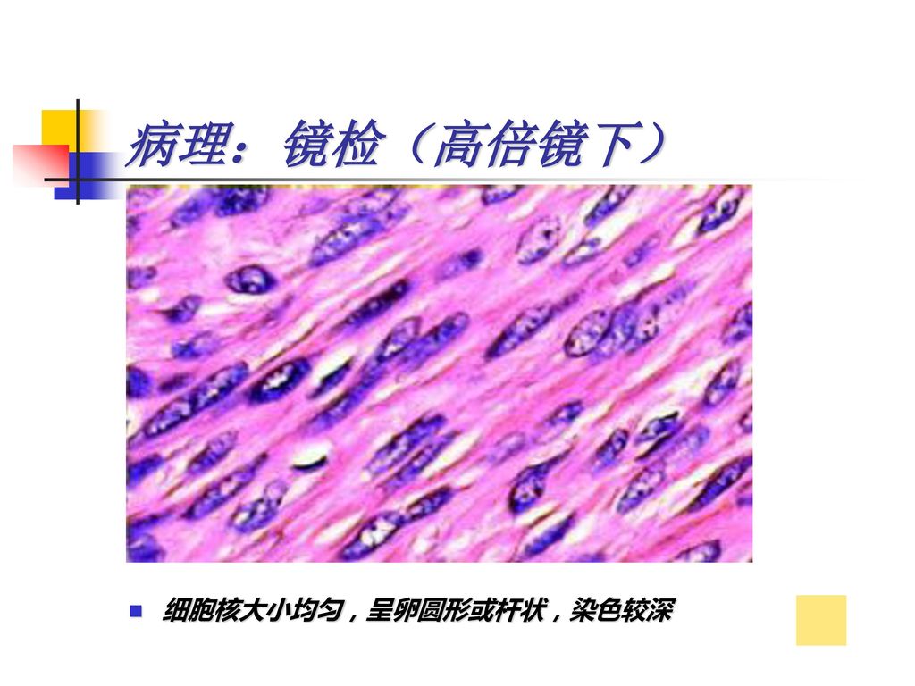 病理：镜检（高倍镜下） 细胞核大小均匀，呈卵圆形或杆状，染色较深