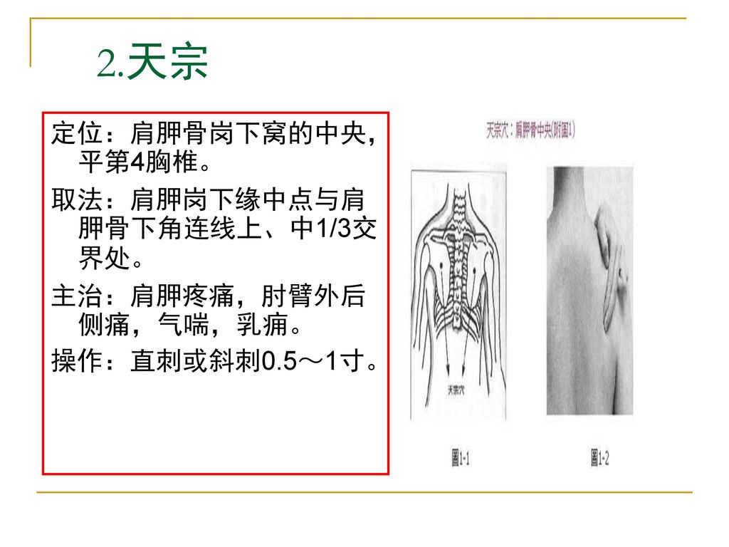 2.天宗 定位：肩胛骨岗下窝的中央，平第4胸椎。 取法：肩胛岗下缘中点与肩胛骨下角连线上、中1/3交界处。
