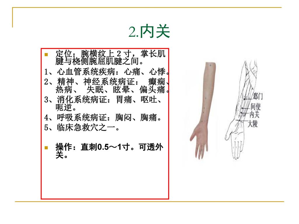 2.内关 定位：腕横纹上２寸，掌长肌腱与桡侧腕屈肌腱之间。 1、心血管系统疾病：心痛、心悸。