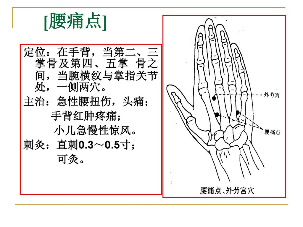 [腰痛点] 定位：在手背，当第二、三掌骨及第四、五掌 骨之间，当腕横纹与掌指关节处，一侧两穴。 主治：急性腰扭伤，头痛； 手背红肿疼痛；