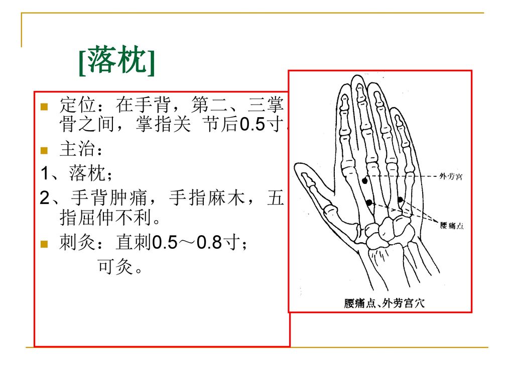 [落枕] 定位：在手背，第二、三掌骨之间，掌指关 节后0.5寸。 主治： 1、落枕； 2、手背肿痛，手指麻木，五指屈伸不利。