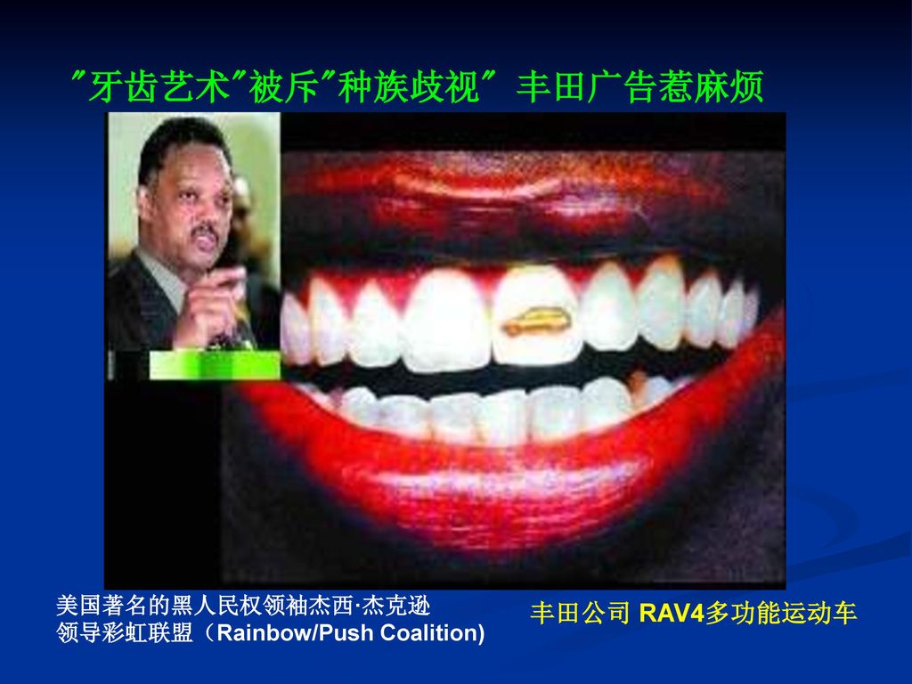 牙齿艺术 被斥 种族歧视 丰田广告惹麻烦 丰田公司 RAV4多功能运动车 美国著名的黑人民权领袖杰西·杰克逊