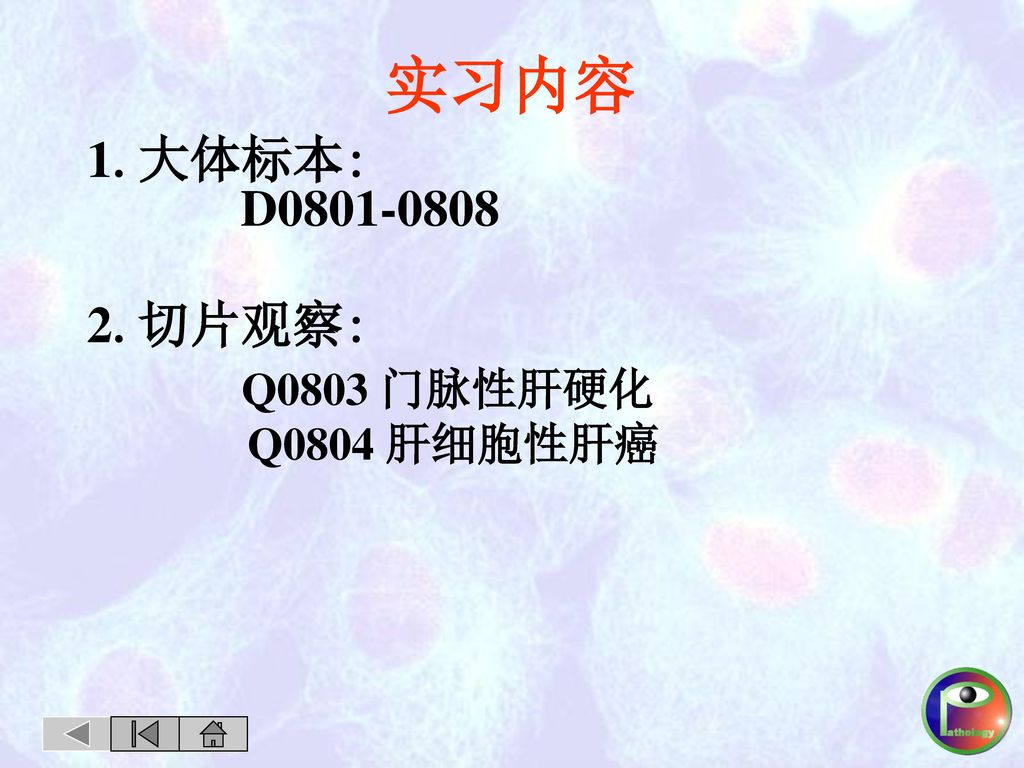 实习内容 1.大体标本: D 切片观察: Q0803 门脉性肝硬化 Q0804 肝细胞性肝癌