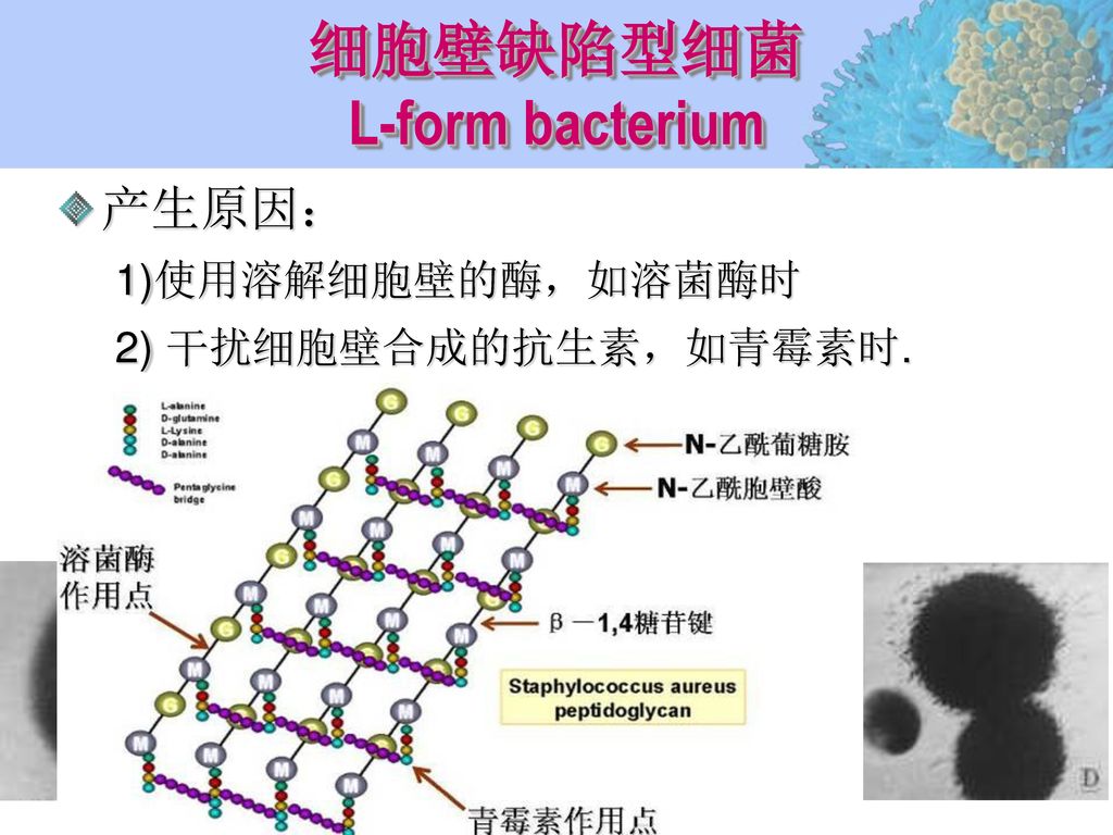 细胞壁缺陷型细菌 L-form bacterium