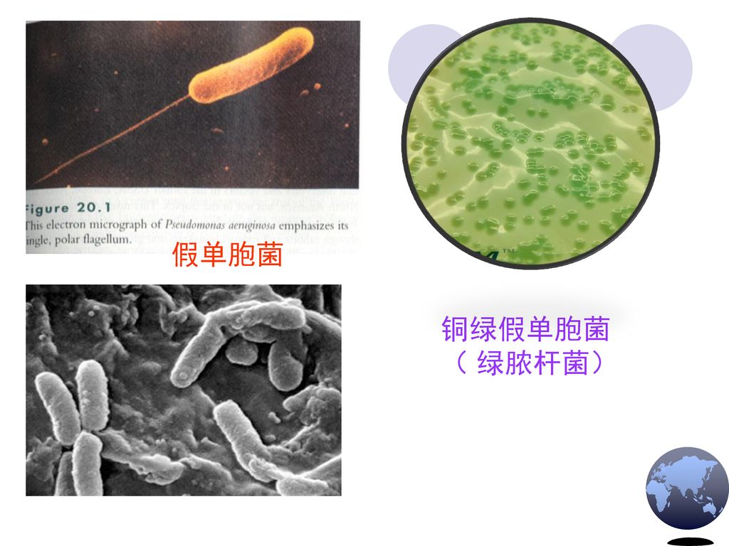 假单胞菌 铜绿假单胞菌 （ 绿脓杆菌）