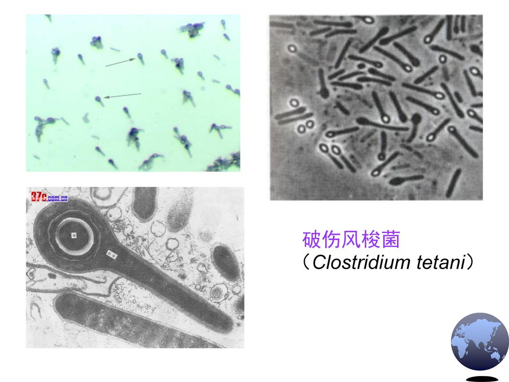 破伤风梭菌 （Clostridium tetani）