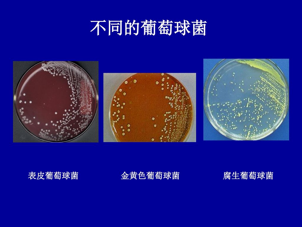 不同的葡萄球菌 表皮葡萄球菌 金黄色葡萄球菌 腐生葡萄球菌