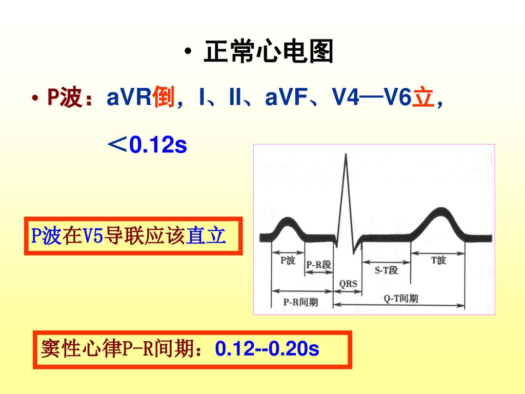 正常心电图 P波：aVR倒，I、II、aVF、V4—V6立， ＜0.12s P波在V5导联应该直立