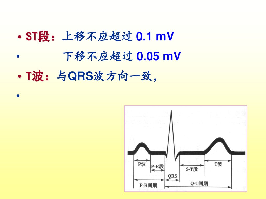 ST段：上移不应超过 0.1 mV 下移不应超过 0.05 mV T波：与QRS波方向一致，