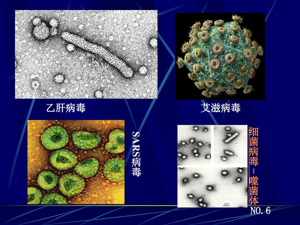 乙肝病毒 艾滋病毒 细菌病毒－噬菌体 SARS病毒 NO.6