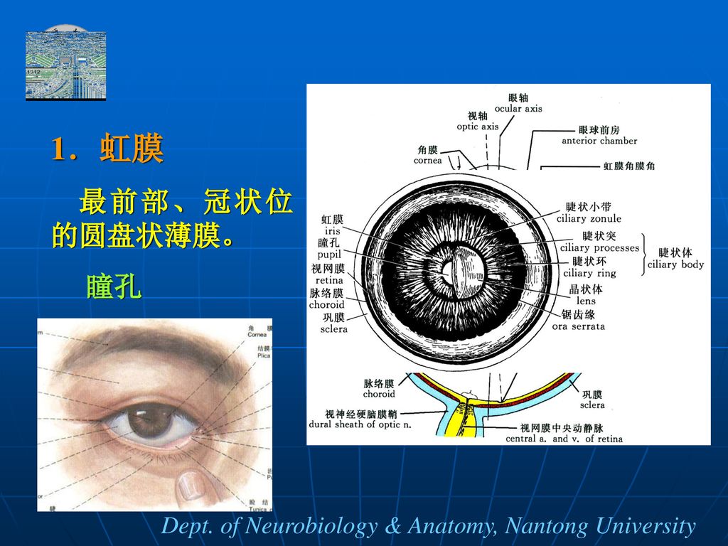 1．虹膜 最前部、冠状位的圆盘状薄膜。 瞳孔