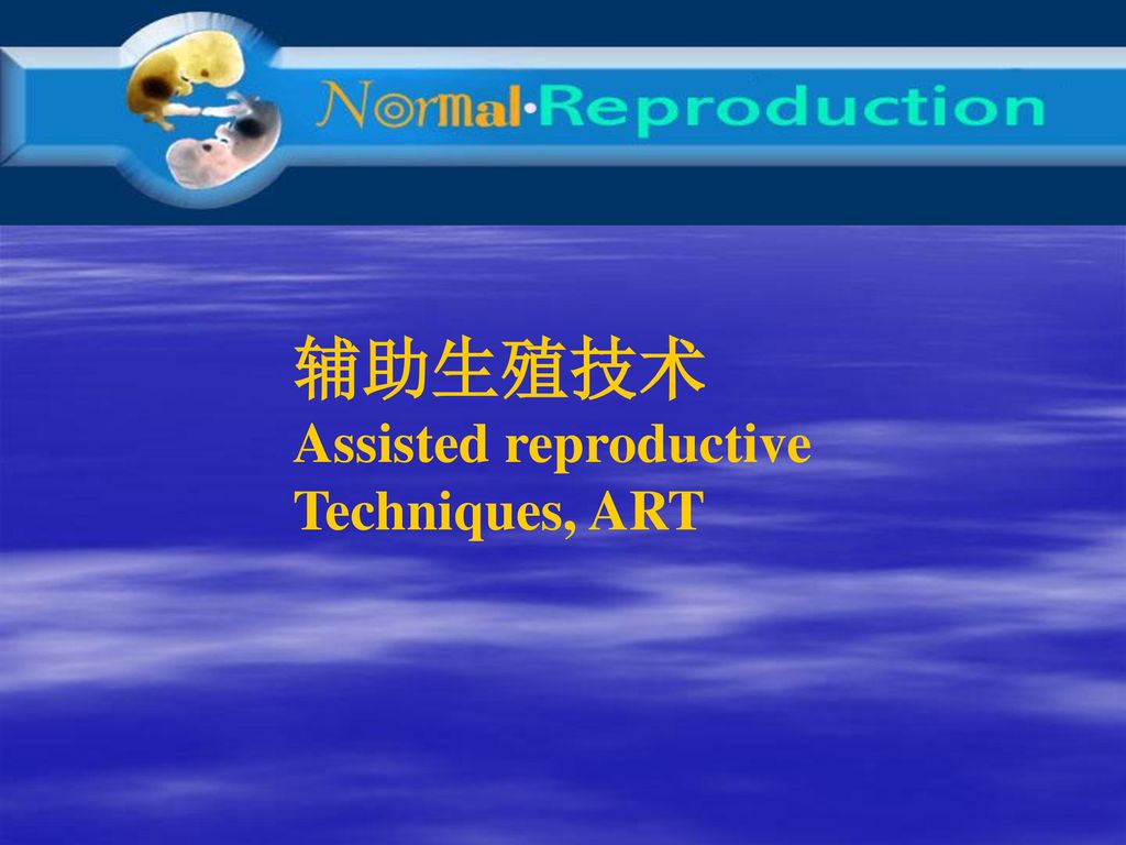 辅助生殖技术 Assisted reproductive Techniques, ART