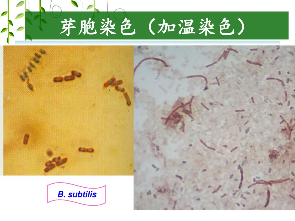 芽胞染色（加温染色） 破伤风梭菌 B. subtilis