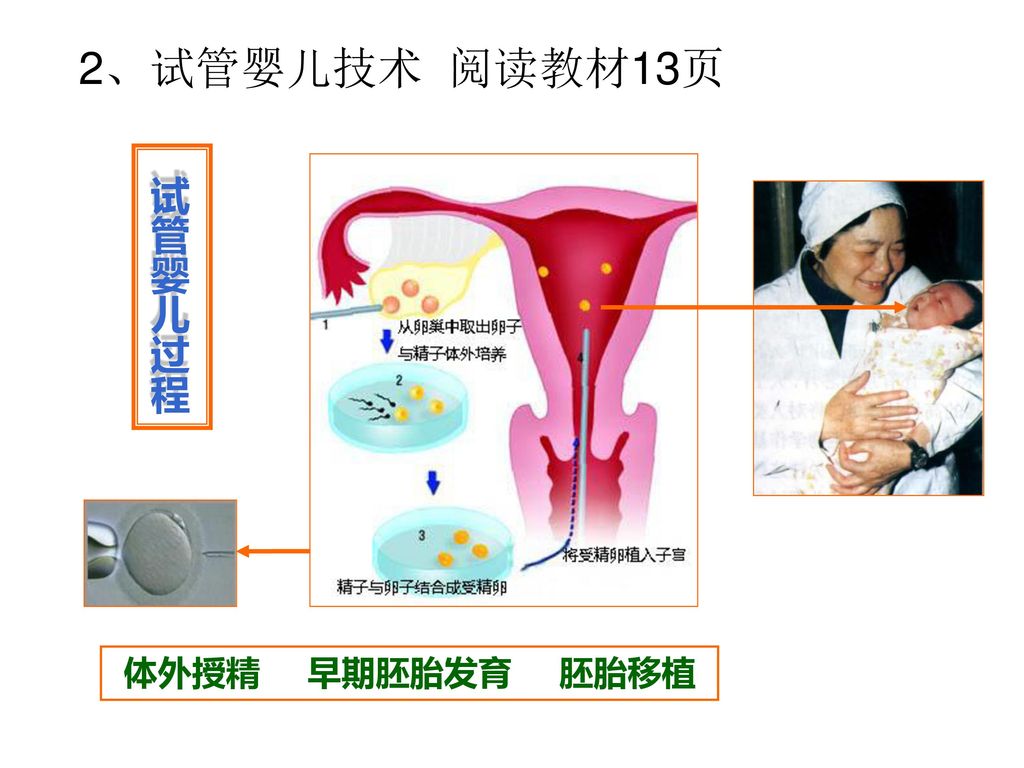 2、试管婴儿技术 阅读教材13页 试管婴儿过程 体外授精 早期胚胎发育 胚胎移植