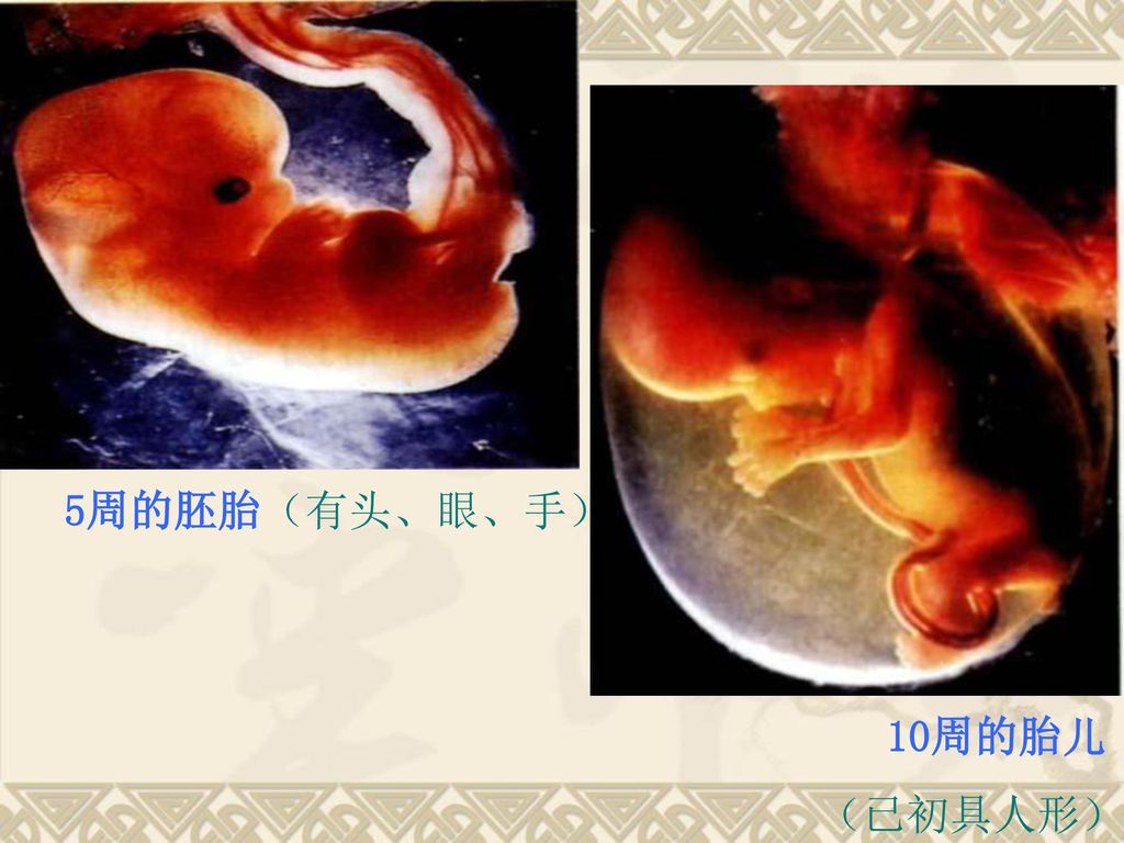 5周的胚胎（有头、眼、手） 10周的胎儿 （已初具人形）