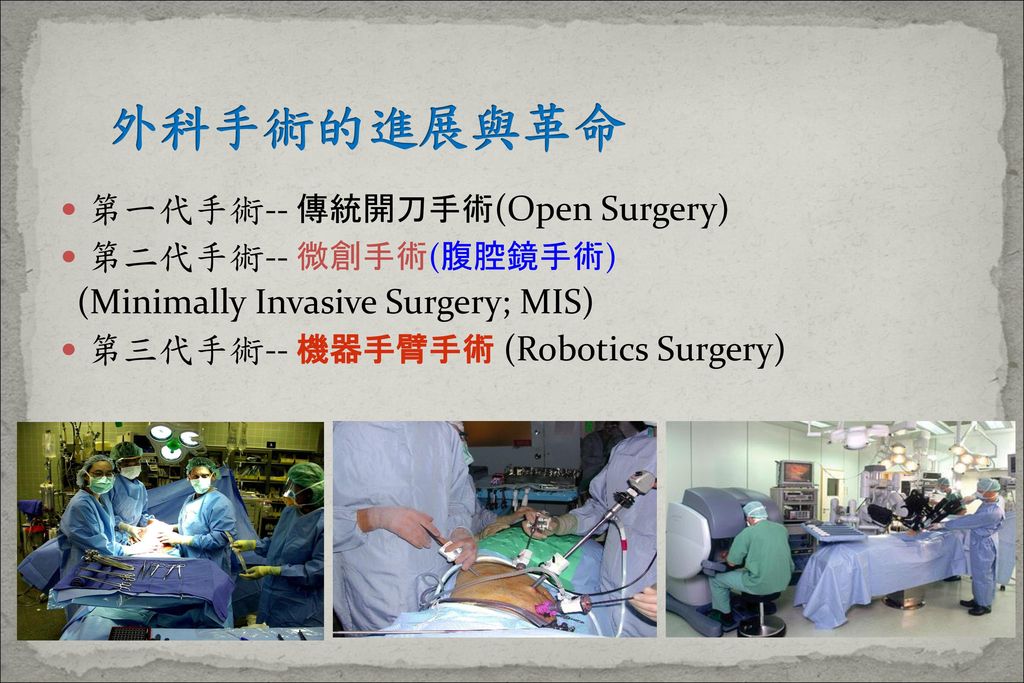 外科手術的進展與革命 第一代手術-- 傳統開刀手術(Open Surgery) 第二代手術-- 微創手術(腹腔鏡手術)