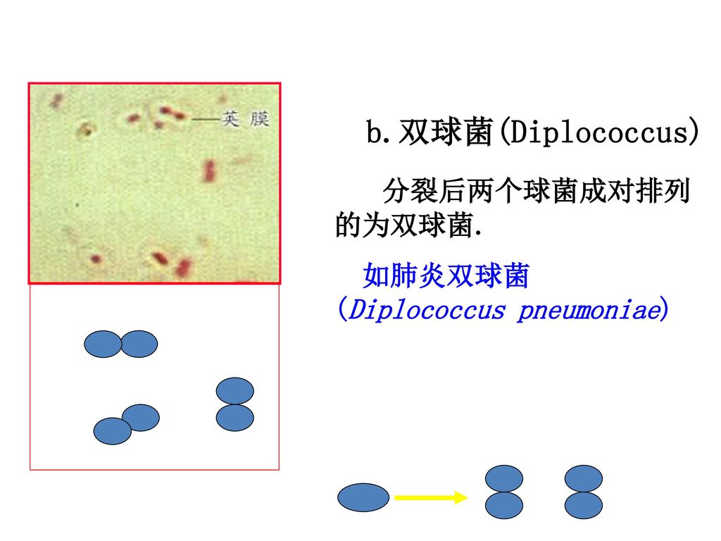 b.双球菌(Diplococcus) 分裂后两个球菌成对排列的为双球菌. 如肺炎双球菌 (Diplococcus pneumoniae)