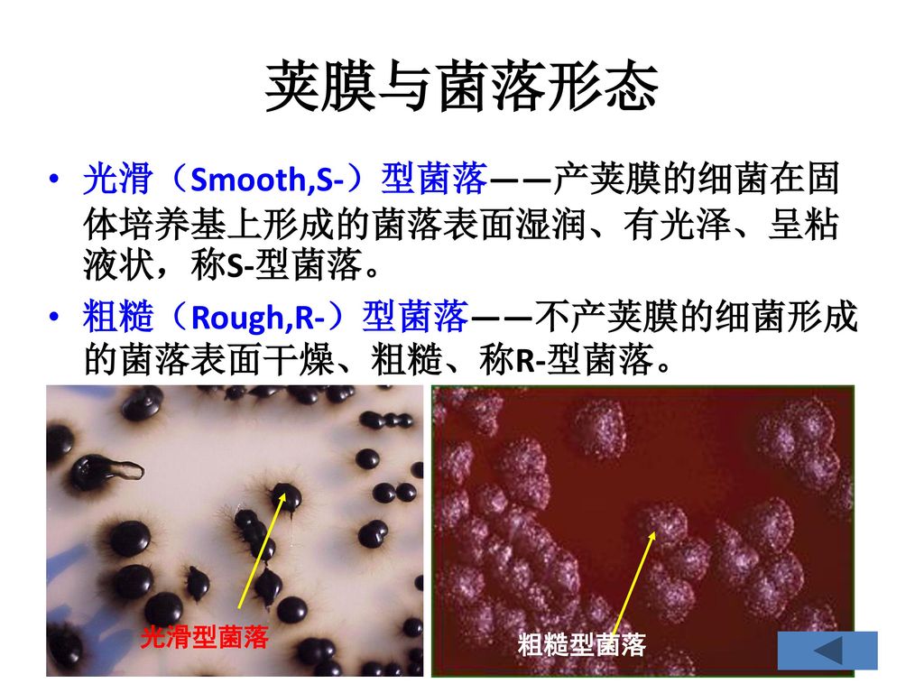 荚膜与菌落形态 光滑（Smooth,S-）型菌落——产荚膜的细菌在固体培养基上形成的菌落表面湿润、有光泽、呈粘液状，称S-型菌落。