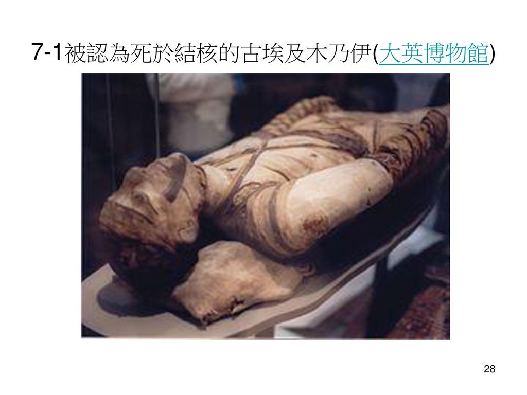 7-1被認為死於結核的古埃及木乃伊(大英博物館)