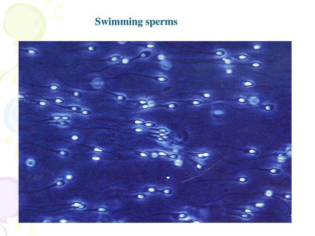 Swimming sperms