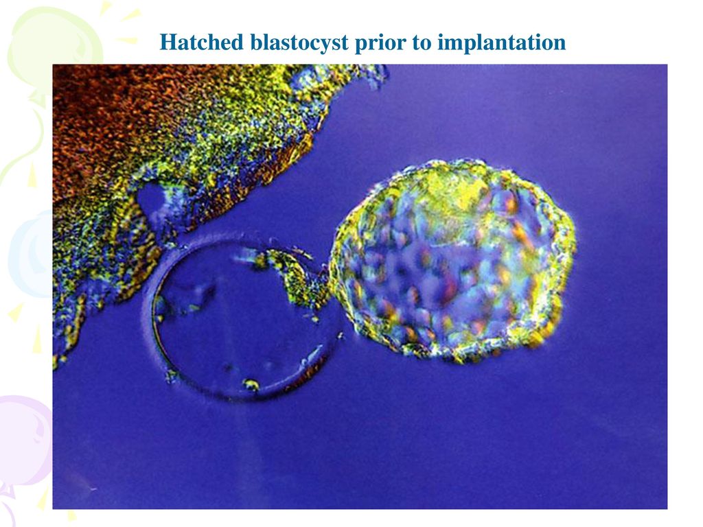Hatched blastocyst prior to implantation
